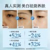 美容院专供祛斑霜美白去黑色素护肤品套盒院线淡去雀斑黄褐斑套装
